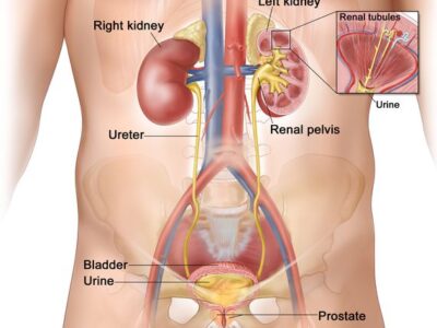 Is lemon water good for kidneys? -Galdin Marlyn